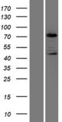 Western Blot: PKC beta Overexpression Lysate (Adult Normal) [NBP2-04488] Left-Empty vector transfected control cell lysate (HEK293 cell lysate); Right -Over-expression Lysate for PKC beta.
