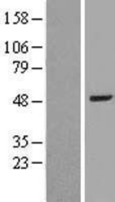 Western Blot: BAAT Overexpression Lysate (Adult Normal) [NBL1-07895] Left-Empty vector transfected control cell lysate (HEK293 cell lysate); Right -Over-expression Lysate for BAAT.