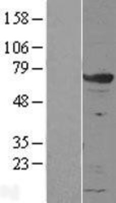 Western Blot: GRB7 Overexpression Lysate (Adult Normal) [NBL1-11327] Left-Empty vector transfected control cell lysate (HEK293 cell lysate); Right -Over-expression Lysate for GRB7.