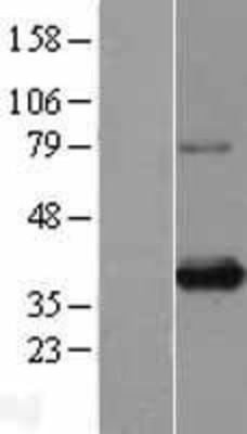 Western Blot: SIX1 Overexpression Lysate (Adult Normal) [NBL1-15982] Left-Empty vector transfected control cell lysate (HEK293 cell lysate); Right -Over-expression Lysate for SIX1.