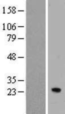 Western Blot: IFNA7 Overexpression Lysate (Adult Normal) [NBP2-06571] Left-Empty vector transfected control cell lysate (HEK293 cell lysate); Right -Over-expression Lysate for IFNA7.