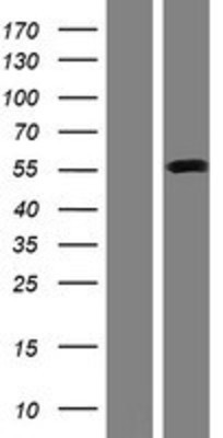 Western Blot: SLC38A1 Overexpression Lysate (Adult Normal) [NBP2-08459] Left-Empty vector transfected control cell lysate (HEK293 cell lysate); Right -Over-expression Lysate for SLC38A1.