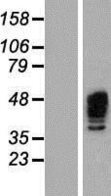 Western Blot: Aurora A Overexpression Lysate (Adult Normal) [NBP2-04699] Left-Empty vector transfected control cell lysate (HEK293 cell lysate); Right -Over-expression Lysate for Aurora A.