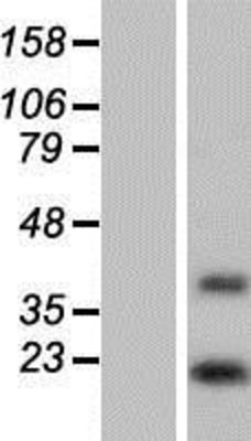 Western Blot: DOLPP1 Overexpression Lysate (Adult Normal) [NBP2-06652] Left-Empty vector transfected control cell lysate (HEK293 cell lysate); Right -Over-expression Lysate for DOLPP1.