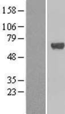 Western Blot: CP2c Overexpression Lysate (Adult Normal) [NBL1-16833] Left-Empty vector transfected control cell lysate (HEK293 cell lysate); Right -Over-expression Lysate for CP2c.