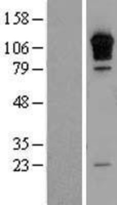 Western Blot: RGS3 Overexpression Lysate (Adult Normal) [NBL1-15332] Left-Empty vector transfected control cell lysate (HEK293 cell lysate); Right -Over-expression Lysate for RGS3.