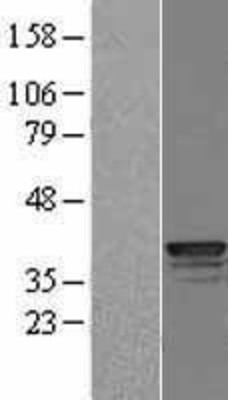 Western Blot: Cathepsin L Overexpression Lysate (Adult Normal) [NBL1-09595] Left-Empty vector transfected control cell lysate (HEK293 cell lysate); Right -Over-expression Lysate for Cathepsin L.