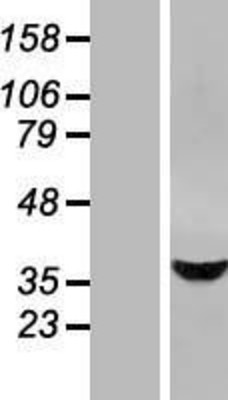 Western Blot: STARD10 Overexpression Lysate (Adult Normal) [NBL1-16517] Left-Empty vector transfected control cell lysate (HEK293 cell lysate); Right -Over-expression Lysate for STARD10.