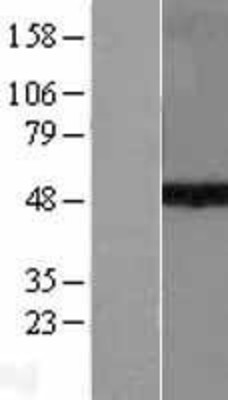 Western Blot: KMT1A/SUV39H1 Overexpression Lysate (Adult Normal) [NBL1-16625] Left-Empty vector transfected control cell lysate (HEK293 cell lysate); Right -Over-expression Lysate for KMT1A/SUV39H1.