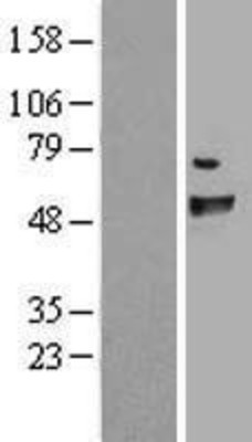 Western Blot: FANCC Overexpression Lysate (Adult Normal) [NBL1-10587] Left-Empty vector transfected control cell lysate (HEK293 cell lysate); Right -Over-expression Lysate for FANCC.