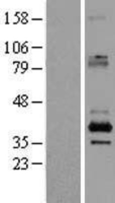 Western Blot: SFXN2 Overexpression Lysate (Adult Normal) [NBL1-15899] Left-Empty vector transfected control cell lysate (HEK293 cell lysate); Right -Over-expression Lysate for SFXN2.