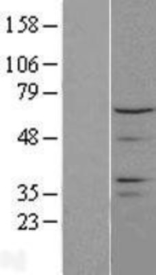Western Blot: CTDSPL2 Overexpression Lysate (Adult Normal) [NBL1-09570] - Western Blot experiments.  Left-Control; Right -Over-expression Lysate for CTDSPL2