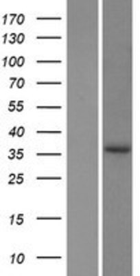 Western Blot: EPDR1 Overexpression Lysate (Adult Normal) [NBP2-06961] Left-Empty vector transfected control cell lysate (HEK293 cell lysate); Right -Over-expression Lysate for EPDR1.