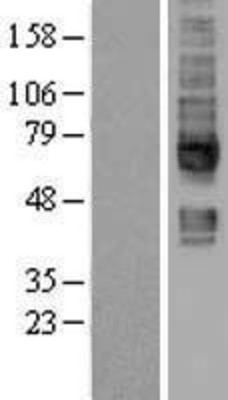 Western Blot: SLC5A6 Overexpression Lysate (Adult Normal) [NBL1-16175] Left-Empty vector transfected control cell lysate (HEK293 cell lysate); Right -Over-expression Lysate for SLC5A6.