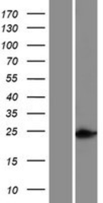 Western Blot: HOXC5 Overexpression Lysate (Adult Normal) [NBP2-06753] Left-Empty vector transfected control cell lysate (HEK293 cell lysate); Right -Over-expression Lysate for HOXC5.