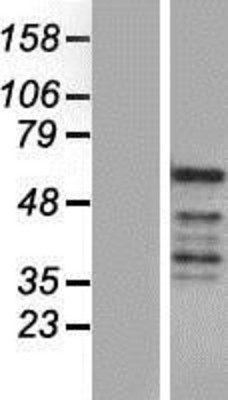 Western Blot: REXO4 Overexpression Lysate (Adult Normal) [NBP2-06655] Left-Empty vector transfected control cell lysate (HEK293 cell lysate); Right -Over-expression Lysate for REXO4.