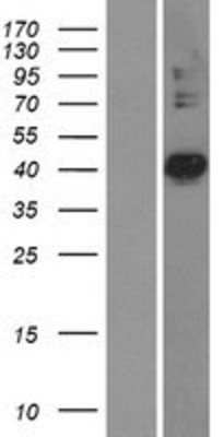 Western Blot: PDSS2 Overexpression Lysate (Adult Normal) [NBL1-14265] Left-Empty vector transfected control cell lysate (HEK293 cell lysate); Right -Over-expression Lysate for PDSS2.