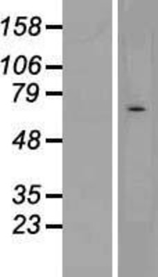 Western Blot: CHRND Overexpression Lysate (Adult Normal) [NBL1-09190] Left-Empty vector transfected control cell lysate (HEK293 cell lysate); Right -Over-expression Lysate for CHRND.