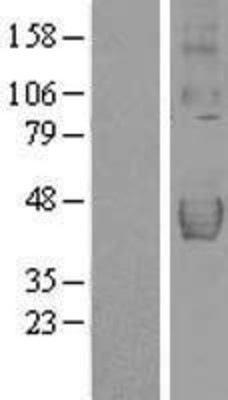 Western Blot: DcR2 Overexpression Lysate (Adult Normal) [NBL1-17144] Left-Empty vector transfected control cell lysate (HEK293 cell lysate); Right -Over-expression Lysate for DcR2.