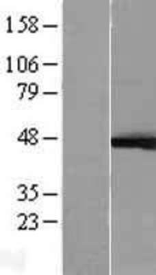 Western Blot: ERK1 Overexpression Lysate (Adult Normal) [NBL1-12877] Left-Empty vector transfected control cell lysate (HEK293 cell lysate); Right -Over-expression Lysate for ERK1.