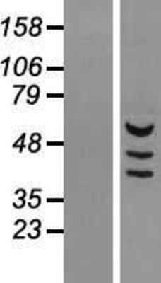 Western Blot: MDH1B Overexpression Lysate (Adult Normal) [NBL1-12965] Left-Empty vector transfected control cell lysate (HEK293 cell lysate); Right -Over-expression Lysate for MDH1B.