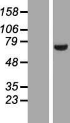 Western Blot: LIM kinase 2 Overexpression Lysate (Adult Normal) [NBP2-06997] Left-Empty vector transfected control cell lysate (HEK293 cell lysate); Right -Over-expression Lysate for LIM kinase 2.