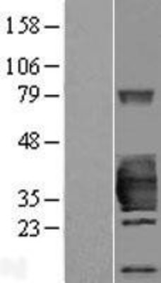 Western Blot: HSD17B14 Overexpression Lysate (Adult Normal) [NBP2-07063] Left-Empty vector transfected control cell lysate (HEK293 cell lysate); Right -Over-expression Lysate for HSD17B14.