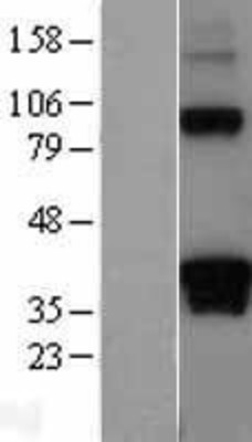 Western Blot: DAZL Overexpression Lysate (Adult Normal) [NBL1-09725] Left-Empty vector transfected control cell lysate (HEK293 cell lysate); Right -Over-expression Lysate for DAZL.