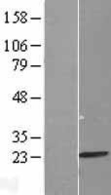Western Blot: MRPL13 Overexpression Lysate (Adult Normal) [NBL1-13236] Left-Empty vector transfected control cell lysate (HEK293 cell lysate); Right -Over-expression Lysate for MRPL13.