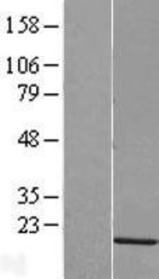Western Blot: HIST1H2AG Overexpression Lysate (Adult Normal) [NBL1-11558] Left-Empty vector transfected control cell lysate (HEK293 cell lysate); Right -Over-expression Lysate for HIST1H2AG.