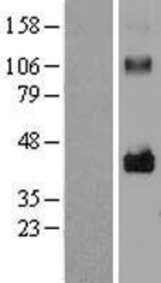 Western Blot: LRRC17 Overexpression Lysate (Adult Normal) [NBL1-12676] Left-Empty vector transfected control cell lysate (HEK293 cell lysate); Right -Over-expression Lysate for LRRC17.