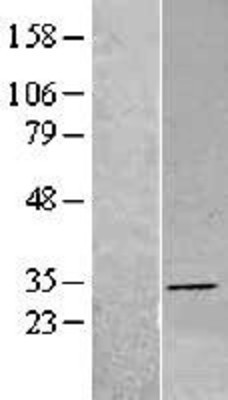 Western Blot: DHRS4 Overexpression Lysate (Adult Normal) [NBL1-09869] Left-Empty vector transfected control cell lysate (HEK293 cell lysate); Right -Over-expression Lysate for DHRS4.