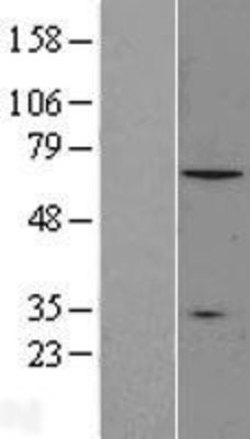 Western Blot: CNOT4 Overexpression Lysate (Adult Normal) [NBL1-09319] Left-Empty vector transfected control cell lysate (HEK293 cell lysate); Right -Over-expression Lysate for CNOT4.