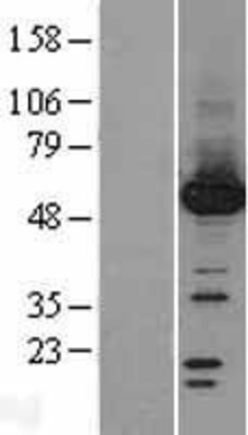 Western Blot: Protein phosphatase 1F Overexpression Lysate (Adult Normal) [NBL1-14661] Left-Empty vector transfected control cell lysate (HEK293 cell lysate); Right -Over-expression Lysate for Protein phosphatase 1F.