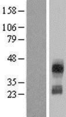 Western Blot: CD300C Overexpression Lysate (Adult Normal) [NBL1-08931] Left-Empty vector transfected control cell lysate (HEK293 cell lysate); Right -Over-expression Lysate for CD300C.