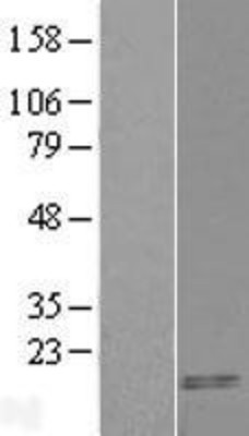 Western Blot: CARTPT Overexpression Lysate (Adult Normal) [NBL1-08700] Left-Empty vector transfected control cell lysate (HEK293 cell lysate); Right -Over-expression Lysate for CARTPT.