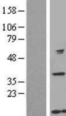 Western Blot: GTF2H5 Overexpression Lysate (Adult Normal) [NBL1-11392] Left-Empty vector transfected control cell lysate (HEK293 cell lysate); Right -Over-expression Lysate for GTF2H5.