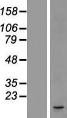 Western Blot: DC2 Overexpression Lysate (Adult Normal) [NBL1-09736] Left-Empty vector transfected control cell lysate (HEK293 cell lysate); Right -Over-expression Lysate for DC2.