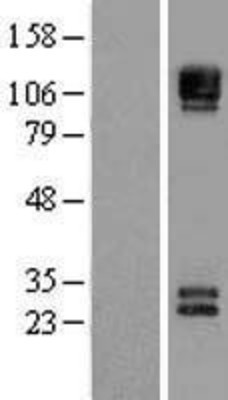 Western Blot: NCAM Overexpression Lysate (Adult Normal) [NBL1-13501] Left-Empty vector transfected control cell lysate (HEK293 cell lysate); Right -Over-expression Lysate for NCAM.