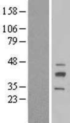 Western Blot: RIBC2 Overexpression Lysate (Adult Normal) [NBL1-15366] Left-Empty vector transfected control cell lysate (HEK293 cell lysate); Right -Over-expression Lysate for RIBC2.
