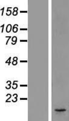 Western Blot: DC2 Overexpression Lysate (Adult Normal) [NBL1-09736] - Western Blot experiments.  Left-Control; Right -Over-expression Lysate for OSTC