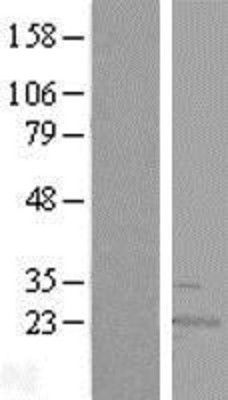 Western Blot: RWDD4A Overexpression Lysate (Adult Normal) [NBL1-15636] Left-Empty vector transfected control cell lysate (HEK293 cell lysate); Right -Over-expression Lysate for RWDD4A.