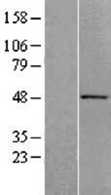 Western Blot: ACTR10 Overexpression Lysate (Adult Normal) [NBL1-07284] Left-Empty vector transfected control cell lysate (HEK293 cell lysate); Right -Over-expression Lysate for ACTR10.