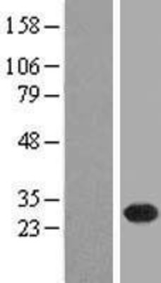 Western Blot: FLJ11184 Overexpression Lysate (Adult Normal) [NBL1-08480] Left-Empty vector transfected control cell lysate (HEK293 cell lysate); Right -Over-expression Lysate for FLJ11184.