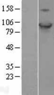 Western Blot: C17orf28 Overexpression Lysate (Adult Normal) [NBL1-08231] Left-Empty vector transfected control cell lysate (HEK293 cell lysate); Right -Over-expression Lysate for C17orf28.