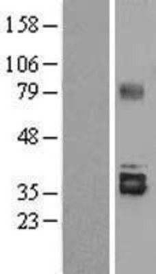 Western Blot: Stanniocalcin 2 Overexpression Lysate (Adult Normal) [NBL1-16534] Left-Empty vector transfected control cell lysate (HEK293 cell lysate); Right -Over-expression Lysate for Stanniocalcin 2.