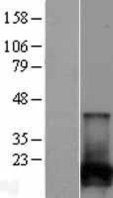 Western Blot: NUDT2 Overexpression Lysate (Adult Normal) [NBL1-13859] Left-Empty vector transfected control cell lysate (HEK293 cell lysate); Right -Over-expression Lysate for NUDT2.