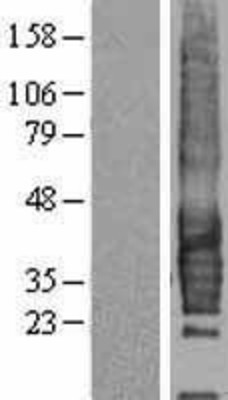 Western Blot: CD37 Overexpression Lysate (Adult Normal) [NBL1-08941] Left-Empty vector transfected control cell lysate (HEK293 cell lysate); Right -Over-expression Lysate for CD37.