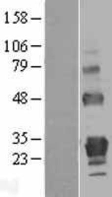 Western Blot: GITR Overexpression Lysate (Adult Normal) [NBL1-17152] Left-Empty vector transfected control cell lysate (HEK293 cell lysate); Right -Over-expression Lysate for GITR.