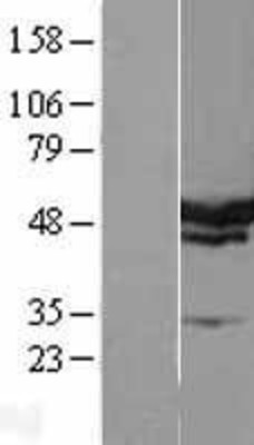 Western Blot: SERBP1 Overexpression Lysate (Adult Normal) [NBL1-15821] Left-Empty vector transfected control cell lysate (HEK293 cell lysate); Right -Over-expression Lysate for SERBP1.